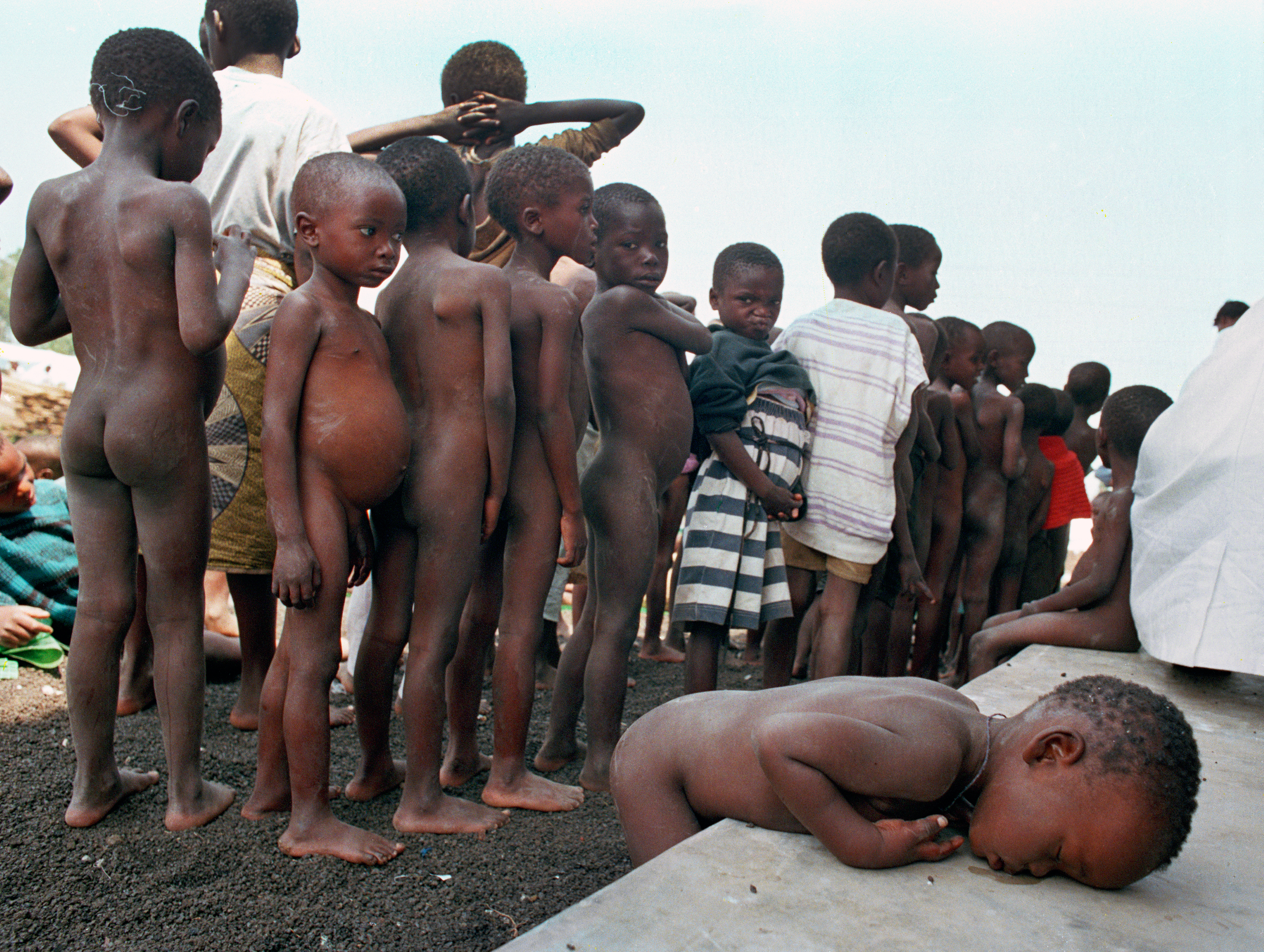 A Rwandan child, too weak from malnutrition to stand in line for vaccination, rests his head on a ledge at a crowded refugee camp for orphaned children in Ndosho, Zaire, July 28, 1994. (AP Photo/Jacqueline Arzt Larma)